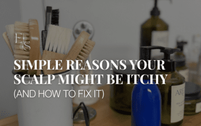 Why Is My Scalp So Itchy? A Holistic Guide